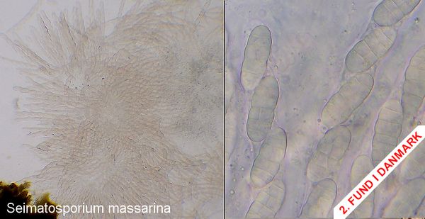  seimatosporium massarina